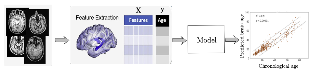 Brain Age pipeline