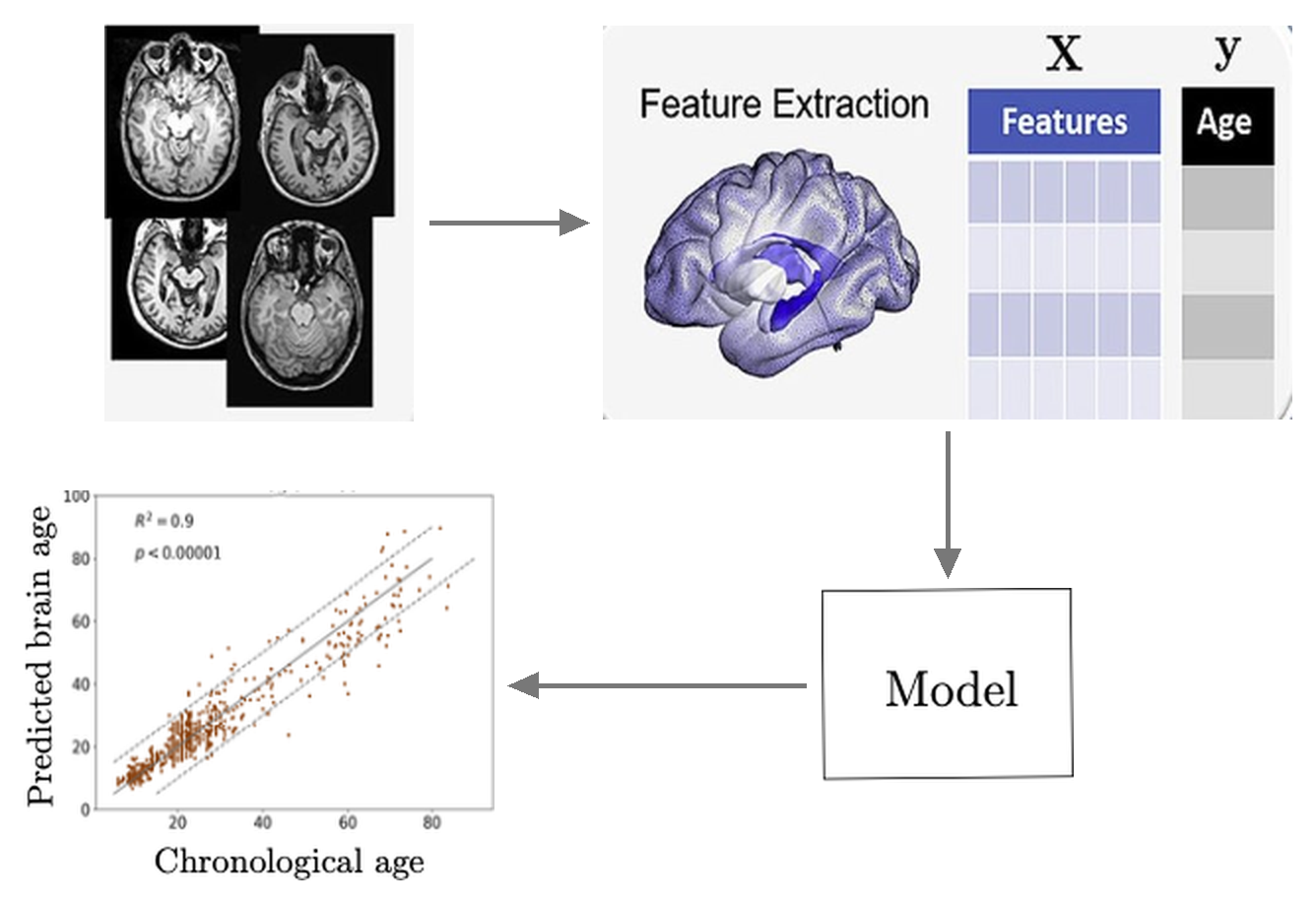 T1-weighted MRI, region-wise feature extraction, a regression model, and predicted against chronological age